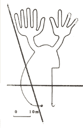 Разное количество пальцев на правой и левой руках